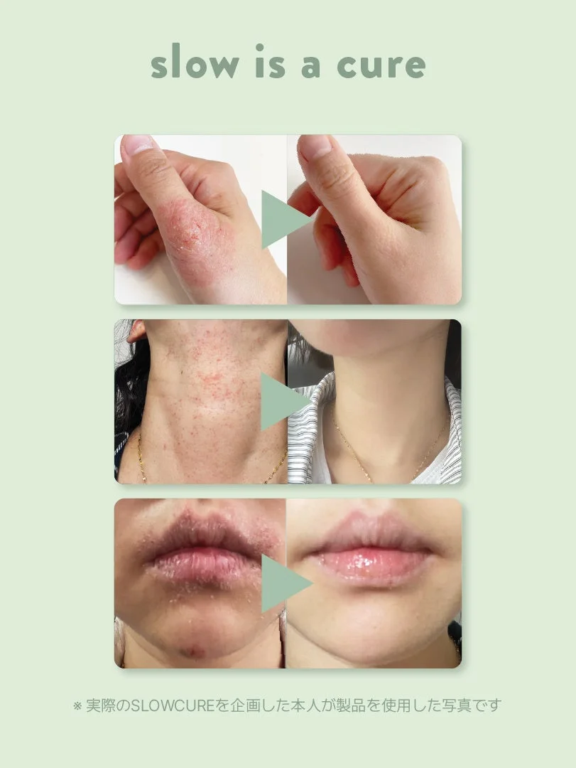 SLOWCURE使用後の肌改善イメージ